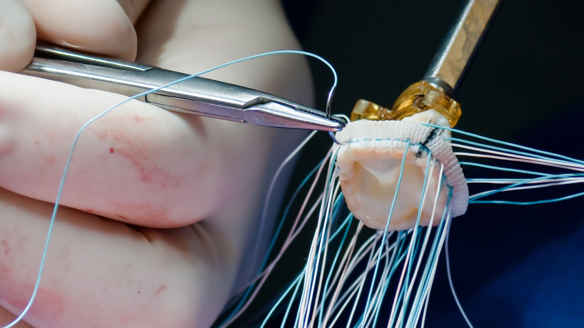 Understanding EU Class III Medical Devices: Regulatory Demands, Lifecycle Oversight, and Strategic Market Readiness